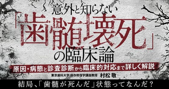 意外と知らない「歯髄壊死」の臨床論