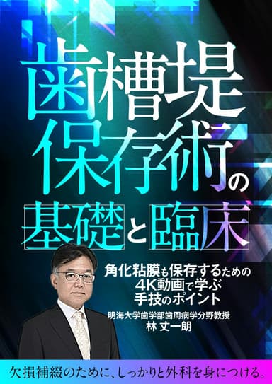 ランキング14位の歯槽堤保存術の基礎と臨床