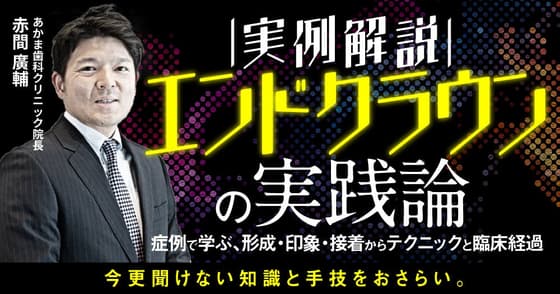 【実例解説】エンドクラウンの実践論