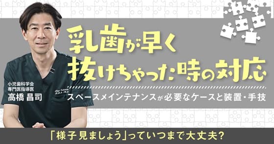 乳歯が早く抜けちゃった時の対応（乳歯の早期喪失）