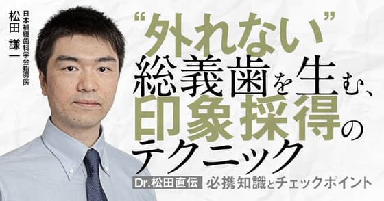 ”外れない”総義歯を生む、印象採得のテクニック。適切に装着するために。