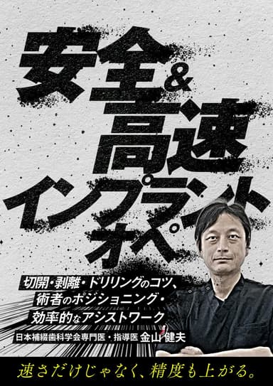 ランキング2位の安全＆高速インプラントオペ