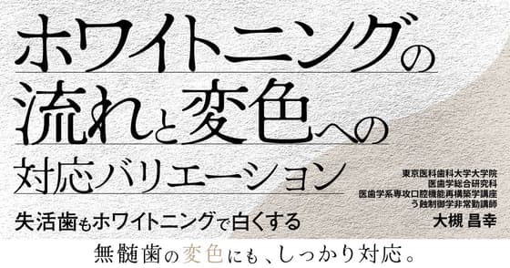 ホワイトニングの流れと歯の変色の原因を理解した上での対応バリエーション