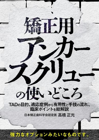 ランキング13位の矯正用アンカースクリューの使いどころ
