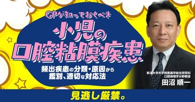 GPが知っておくべき「小児の口腔粘膜疾患」