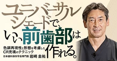ユニバーサルシェードで、いい前歯部は作れる。