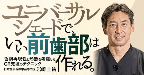 ユニバーサルシェードで、いい前歯部は作れる。