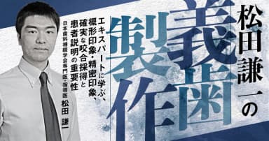 松田謙一の義歯製作
