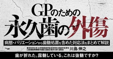 GPのための「永久歯の外傷」