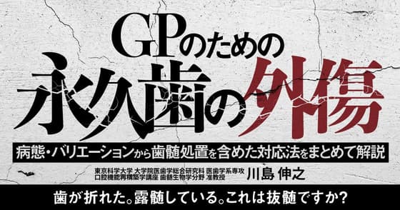 GPのための「永久歯の外傷」