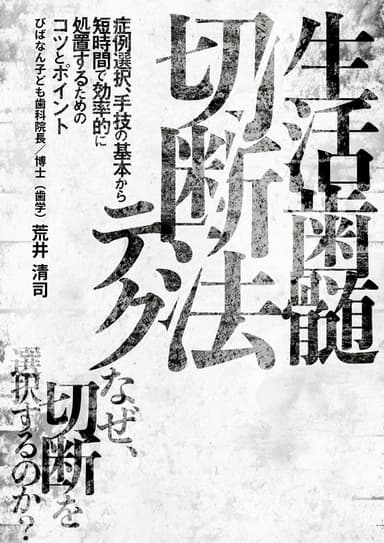 ランキング16位の生活歯髄切断法テク