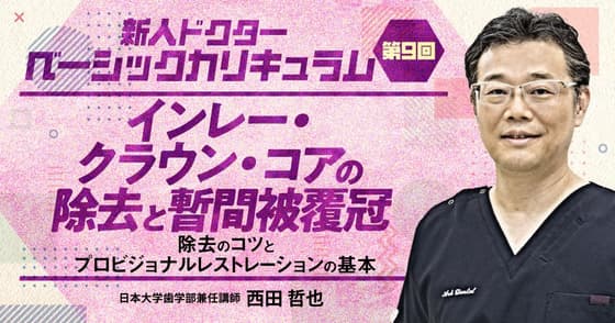 インレー・クラウン・コアの除去と暫間被覆冠