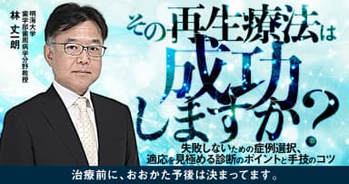 その再生療法は成功しますか？