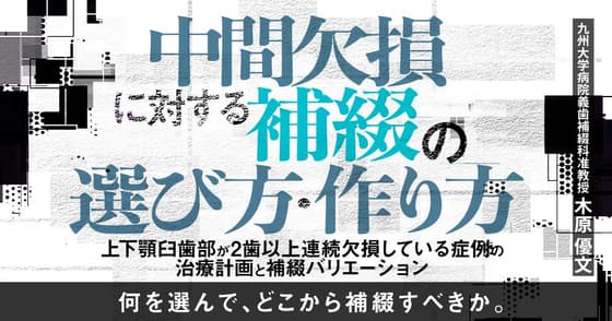 中間欠損に対する補綴の選び方・作り方