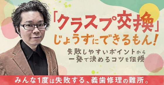 「クラスプ交換」じょうずにできるもん！クラスプ義歯の症例などを解説。