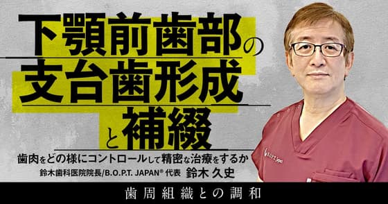 下顎前歯部の支台歯形成と補綴