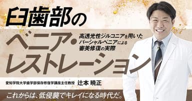 臼歯部のベニア・レストレーション