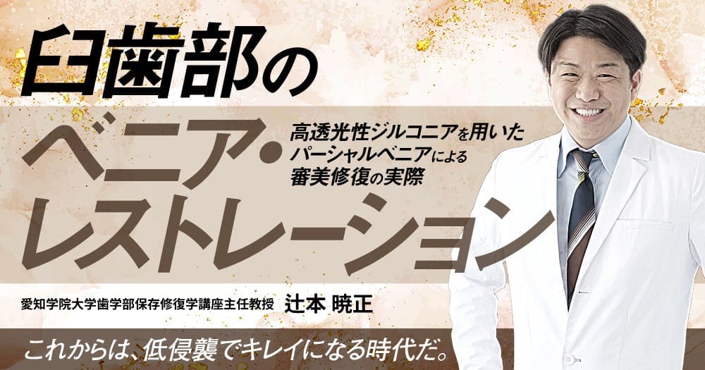 臼歯部のベニア・レストレーション
