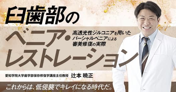 臼歯部のベニア・レストレーション