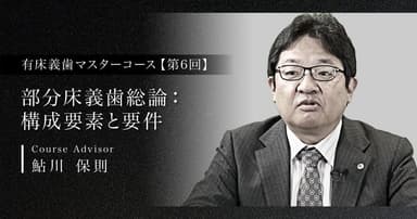 【第6回】部分床義歯総論：構成要素と要件