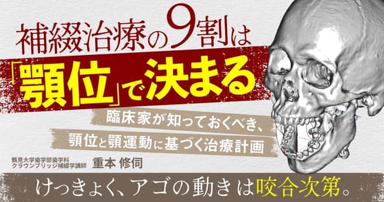 補綴治療の9割は「顎位」で決まる