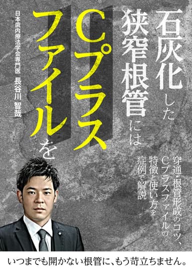 ランキング10位の石灰化した狭窄根管には「Cプラスファイル」を