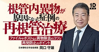 根管内異物が原因となった症例の再根管治療