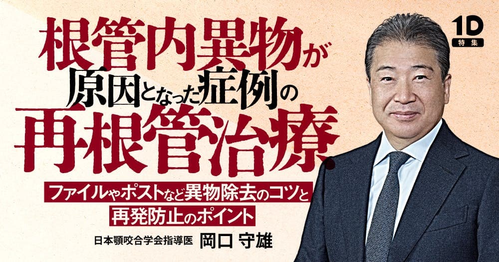 根管内異物が原因となった症例の再根管治療