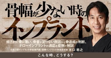骨幅が少ない時のインプラント