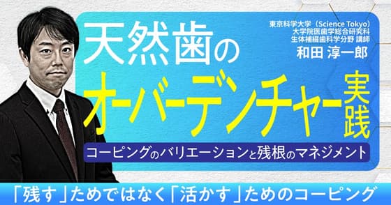 天然歯のオーバーデンチャー実践