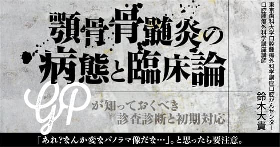 顎骨骨髄炎の病態と臨床論