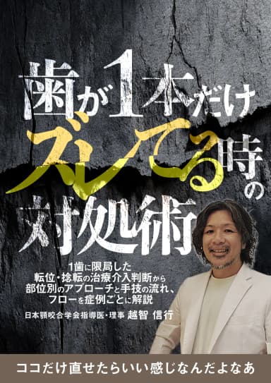 ランキング12位の歯が1本だけズレてる時の対処術