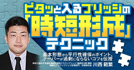 ピタッと入るブリッジの「時短形成」テクニック