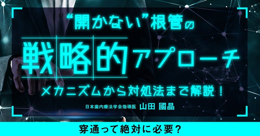 ”開かない”根管の戦略的アプローチ