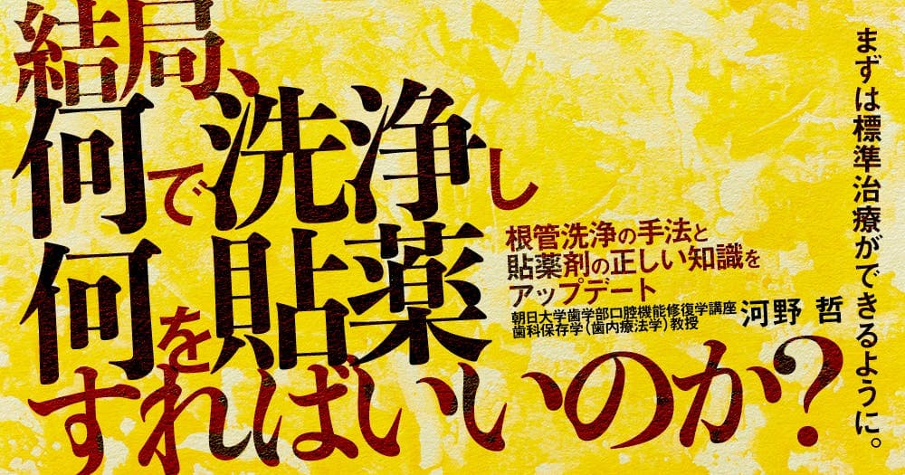 結局、何で洗浄し何を貼薬すればいいのか？ - 根管洗浄の手法と貼薬剤の正しい知識をアップデート