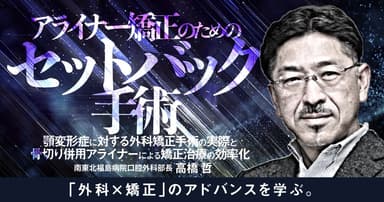 アライナー矯正のための「セットバック手術」