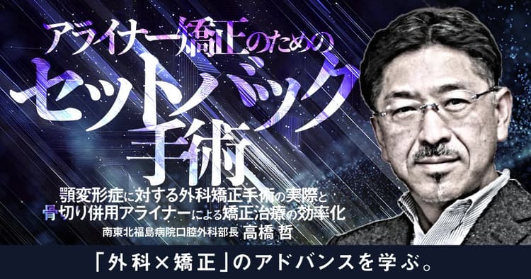 アライナー矯正のための「セットバック手術」