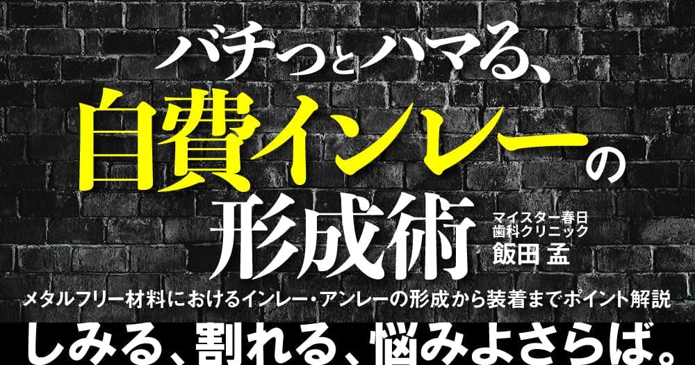 バチっとハマる、自費インレーの形成・修復術。セラミックインレーは金属アレルギーリスクが低い。