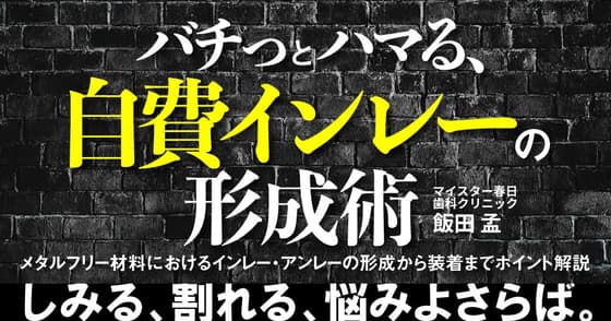 バチっとハマる、自費インレーの形成・修復術。セラミックインレーは金属アレルギーリスクが低い。
