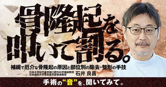 骨隆起を叩いて割る。