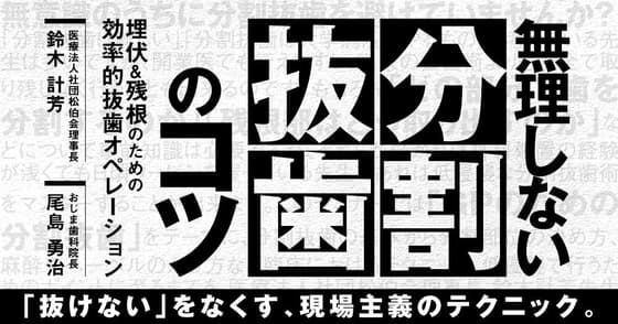 無理しない「分割抜歯」のコツ