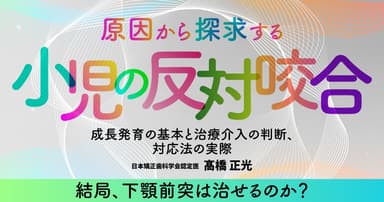 原因から探求する「小児の反対咬合」