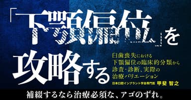 「下顎偏位」を攻略する。顎偏位の症例や症状は？