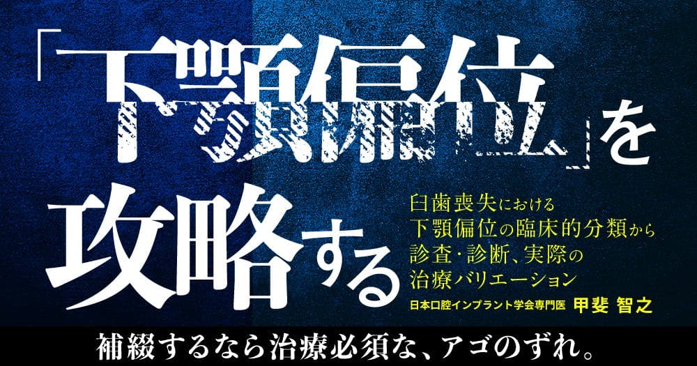 「下顎偏位」を攻略する。顎偏位の症例や症状は？
