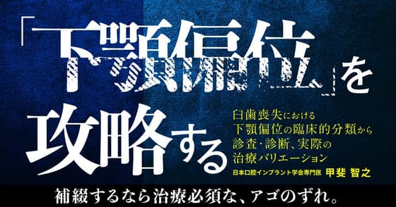 「下顎偏位」を攻略する。顎偏位の症例や症状は？