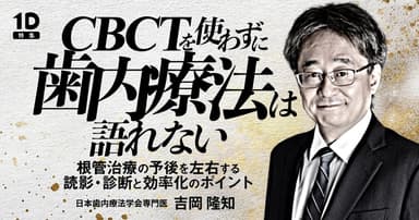 CBCTを使わずに歯内療法は語れない