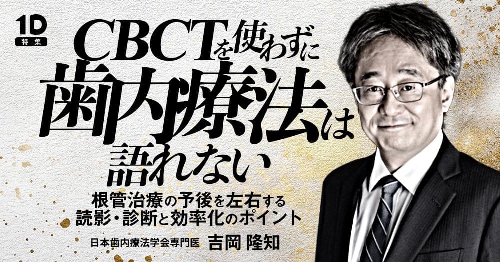 CBCTを使わずに歯内療法は語れない
