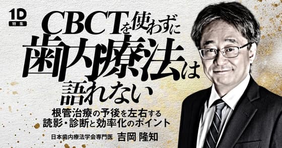 CBCTを使わずに歯内療法は語れない