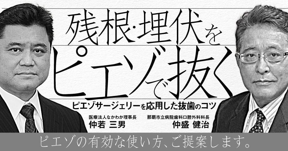 残根・埋伏をピエゾで抜く - ピエゾサージェリーを応用した抜歯のコツ