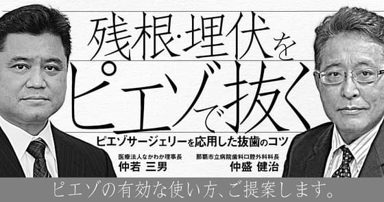 残根・埋伏をピエゾで抜く